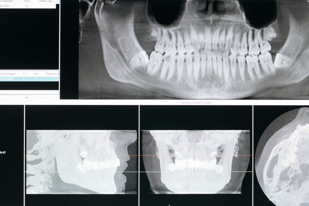 XDR Radiology: The Ultimate Guide | Zenith Dental IT